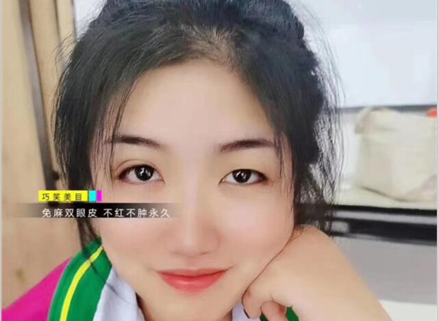 麗竹學(xué)?！凹y繡+雙眼皮”課程開講