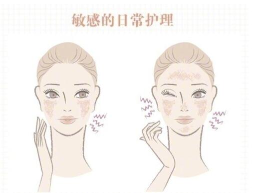 敏感肌保養(yǎng)大全！