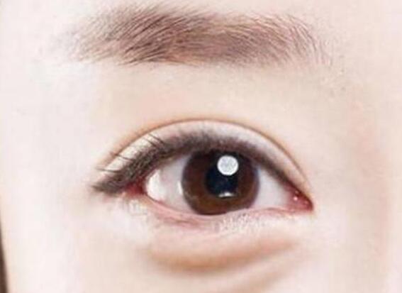 南寧美容學(xué)校福音：眼袋妹子有救了!