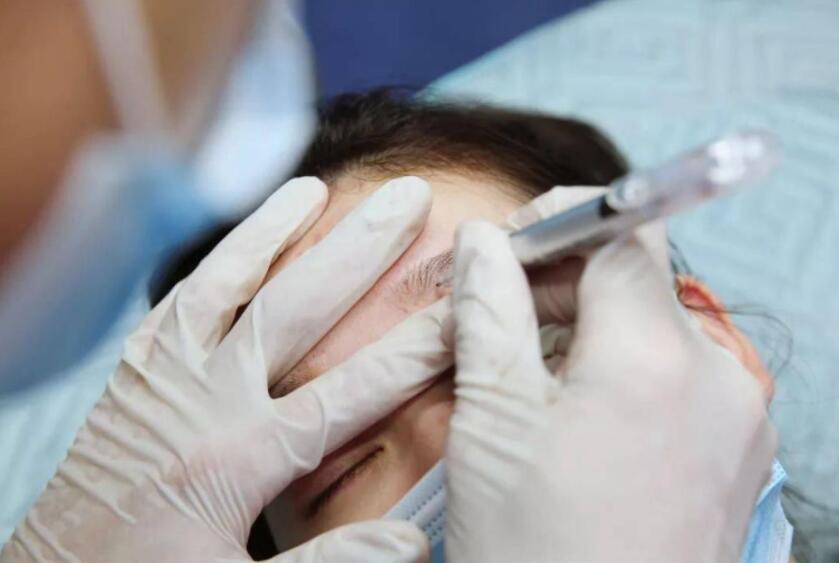 紋繡遇到容易出血的皮膚怎么辦？南寧專業(yè)紋繡培訓教你