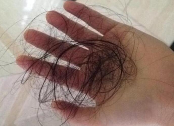 脫發(fā)女孩必備寶典！南寧美發(fā)學(xué)校教你