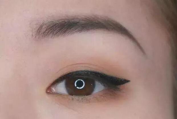 眼尾三角區(qū)怎么處理？