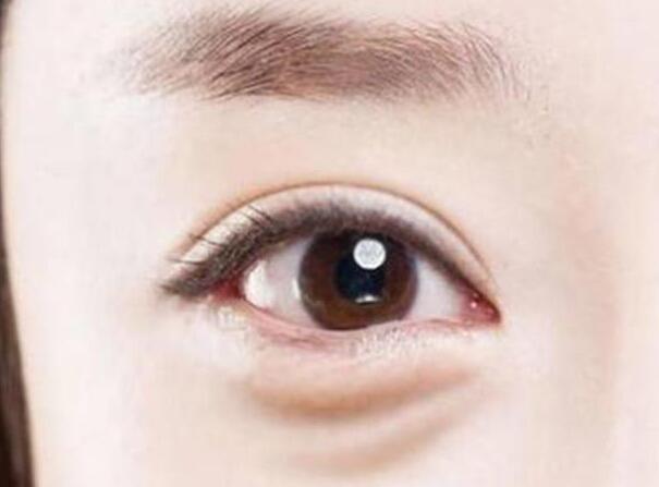 眼袋？淚溝？臥蠶？南寧美容學(xué)校教你辨別