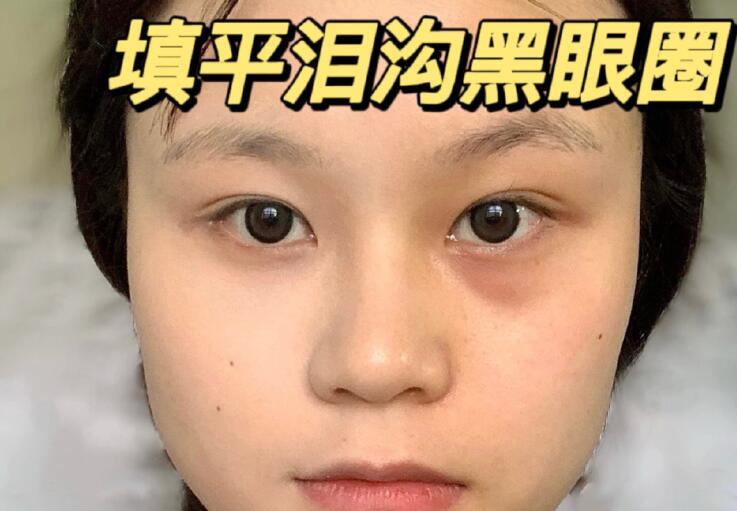 填平淚溝黑眼圈教程，廣西南寧化妝學校分享