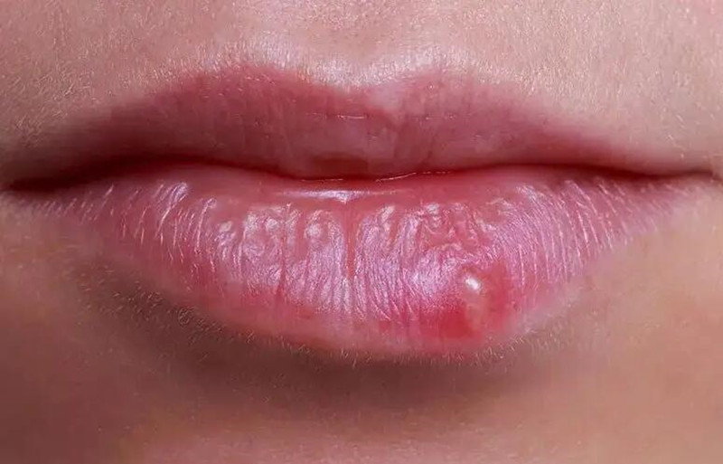 紋唇后起泡怎么辦？南寧紋唇培訓(xùn)學(xué)校教你方法