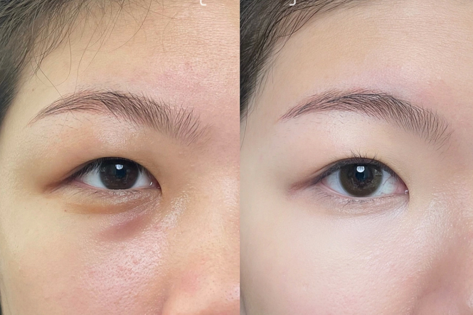 新手遮瑕教程，南寧化妝課程基礎(chǔ)分享