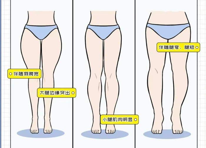 腿粗女生穿搭攻略，廣西彩妝造型搭配