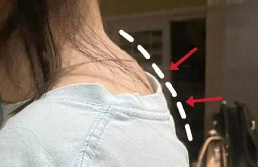 廣西美容養(yǎng)生培訓---頸椎管理技巧