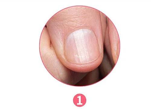 女生氣血不足六大表現(xiàn)，南寧美容養(yǎng)生資訊報道