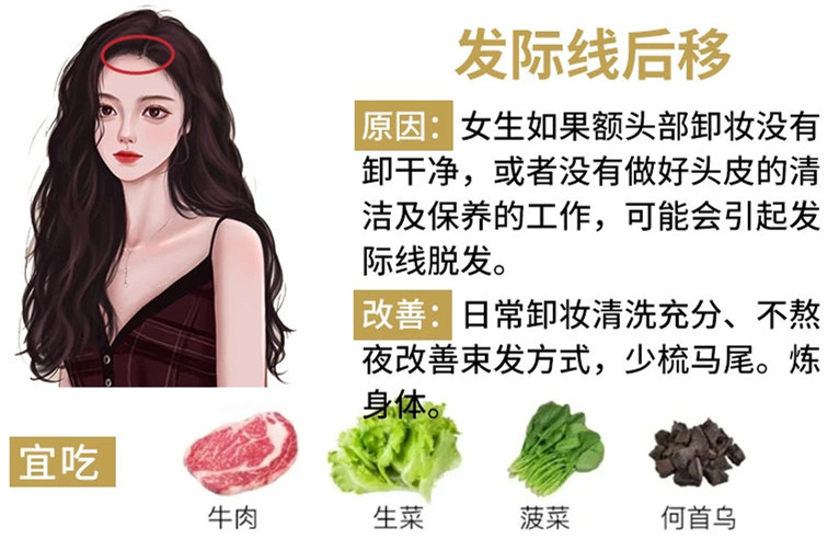 如何改善掉頭發(fā)？南寧頭療養(yǎng)發(fā)護發(fā)教學