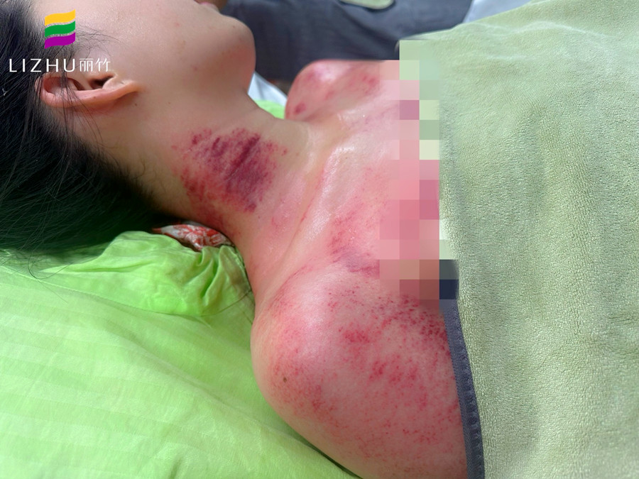 廣西學(xué)刮痧培訓(xùn)班 | 廣西學(xué)刮痧學(xué)費(fèi)多少？