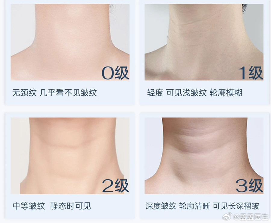 如何緩解頸紋？南寧美體美容管理培訓(xùn)