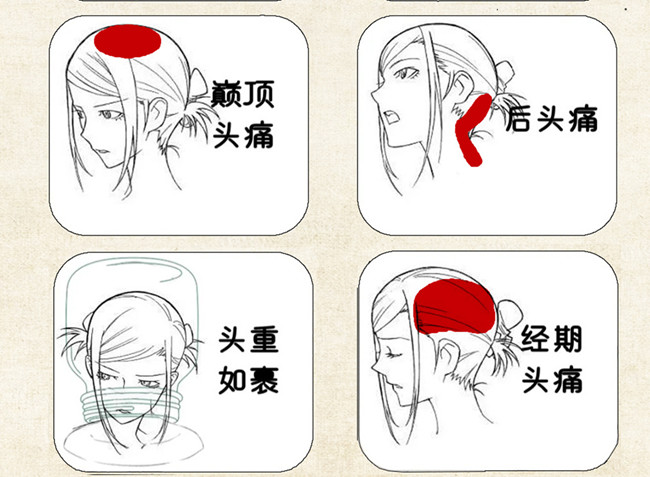 不同頭痛類型經(jīng)絡(luò)護理方法，廣西中醫(yī)美容培訓(xùn)