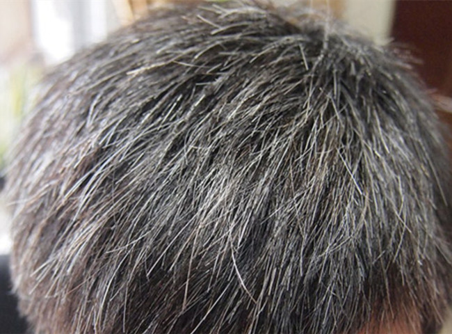 南寧美發(fā)基礎(chǔ)教學：為什么會長白頭發(fā)？