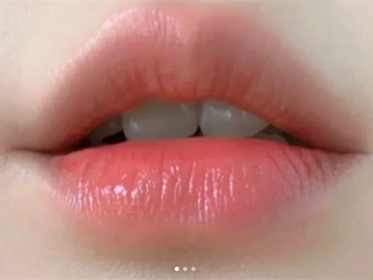 廣西學(xué)紋唇：紋唇遇到組織液時如何應(yīng)付？